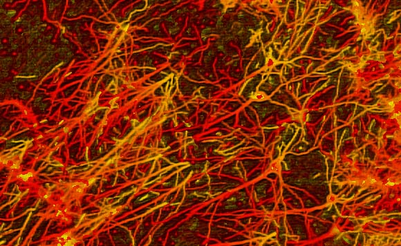 network of neurons